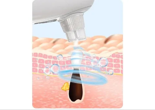 HYDRAFACIAL PORTATIL
